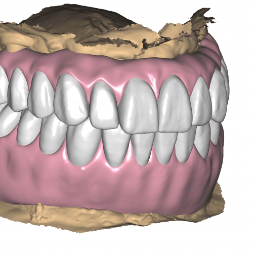 DentalCADHighResScreenshot-2022-02-04_15-07-40-3600x2160