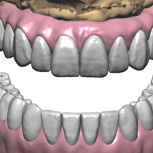 DentalCADHighResScreenshot-2022-02-04_15-10-33-3600x2160