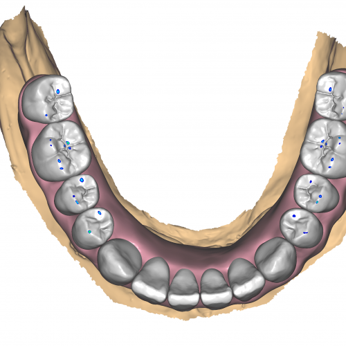 DentalCADHighResScreenshot-2022-02-04_15-14-21-3600x2160