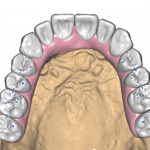 DentalCADHighResScreenshot-2022-02-04_15-15-35-3600x2160