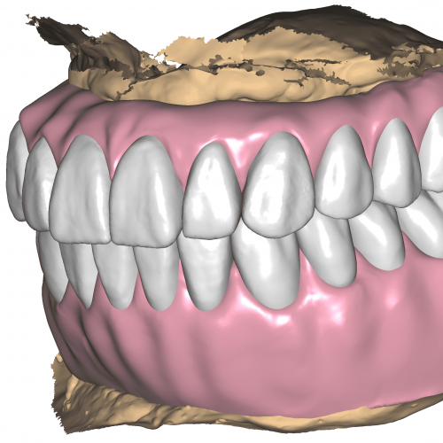 DentalCADHighResScreenshot-2022-02-04_15-16-40-3600x2160